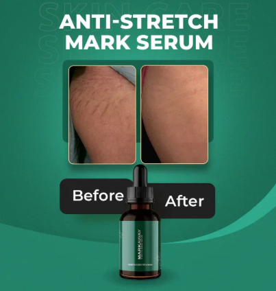 Markaway Advanced Stretch Mark Serum